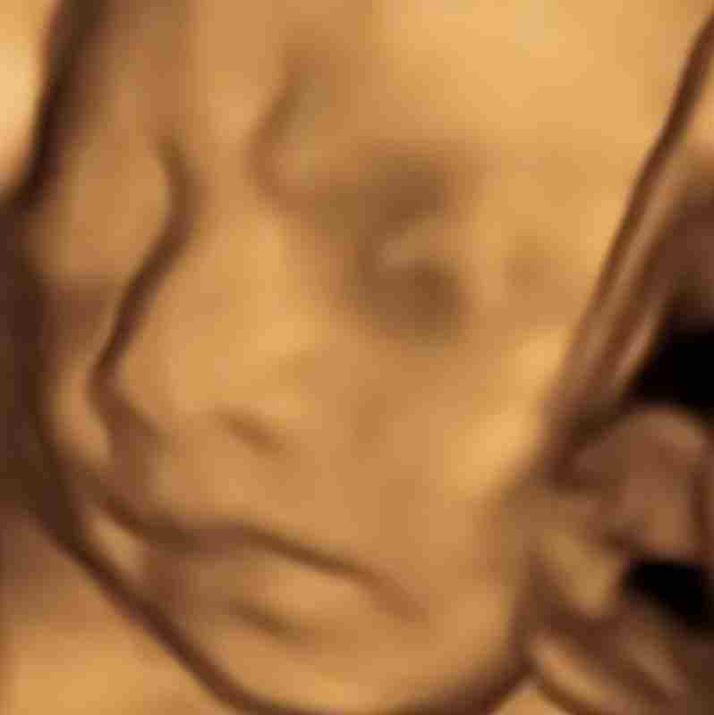 AI四维彩超预测，一单9.9-98，3分钟出图，一天变现1000+【揭秘】